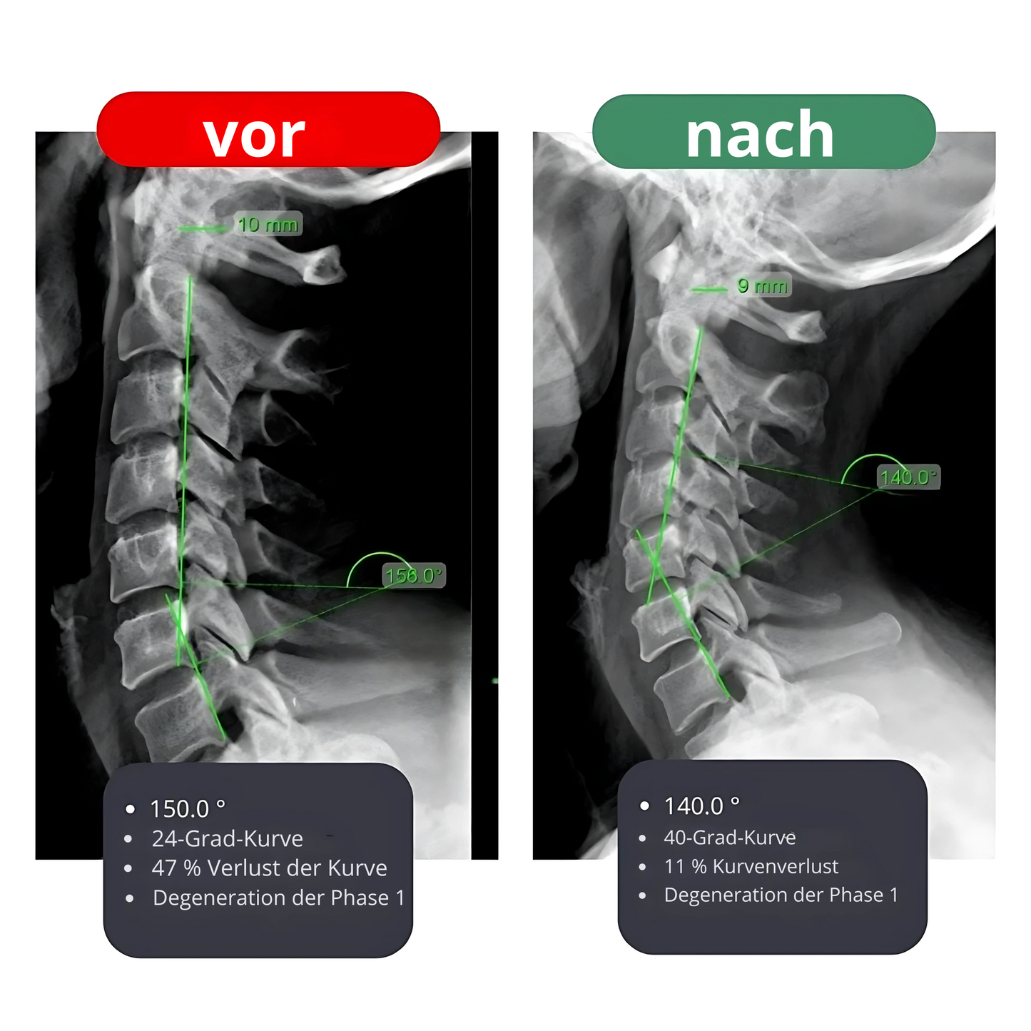 4-in-1 Nackenmassagegerät